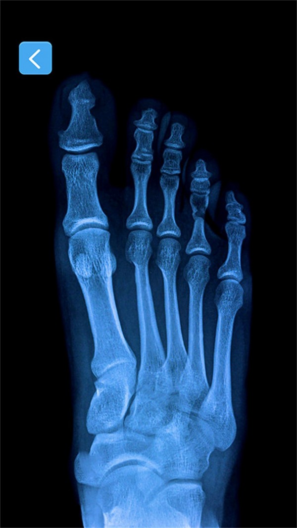 正常人的右脚骨骼图图片