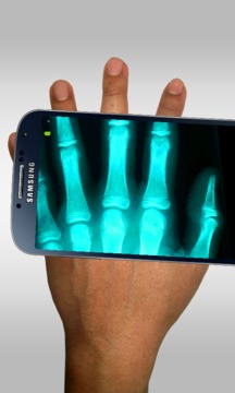 x光扫描仪 Xray scanner0