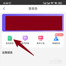 健康山西如何查看检验报告