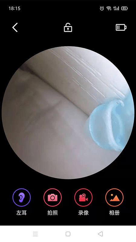 EAR3
