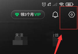 抖音视频同步汽水音乐怎么关闭
