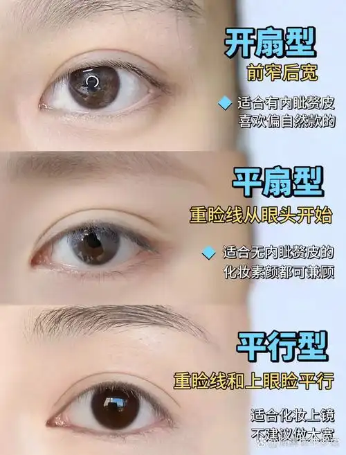 wink双眼皮在哪